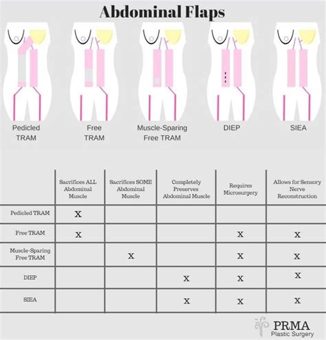 Pin On Breast Reconstruction Information
