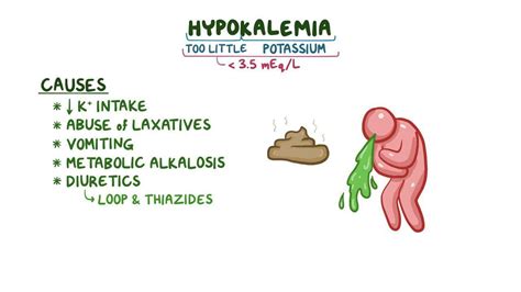 Hypokalemia Clinical Video Anatomy And Definition Osmosis