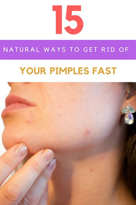 How To Get Rid Of Pimples 15 Home Remedies That Work