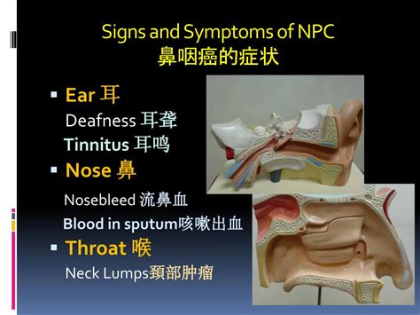 Ppt Signs And Symptoms Of Head And Neck Cancers 头部与頚部癌症的症状 Powerpoint