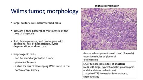 Tumors Of Kidney And Urinary Bladder Ppt Download