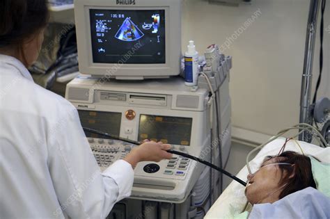 Transesophageal Echography Stock Image C0040558 Science Photo