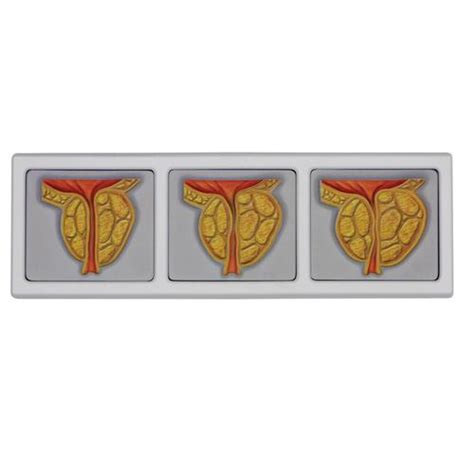 Male Pelvis With 3d Prostate Frame 1019563 3551 Genital And Pelvis Models Anatomical Models