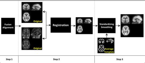 Frontiers Interpretable Recognition For Dementia Using Brain Images