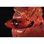 Gallbladder Inflammation Photograph By Cnri/science Photo Library