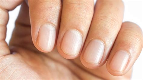 Fingernail Ridges Causes And Treatments For Vertical And Horizontal