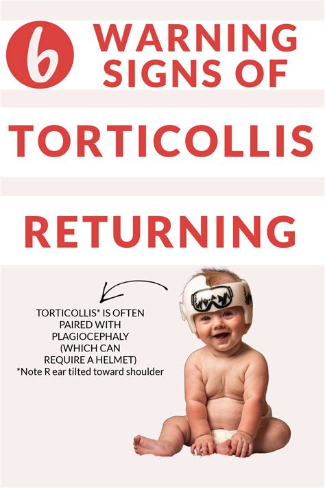6 Warning Signs Of Torticollis And What To Do If It Returns — In Home Pediatric Physical Therapy