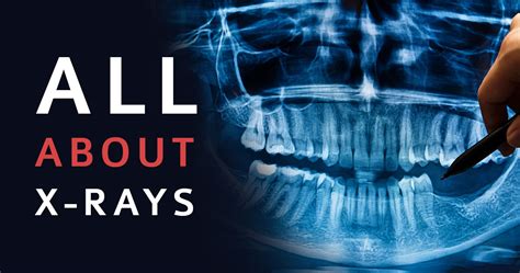A Guide To Dental X Rays Fiorillo Dental Blog