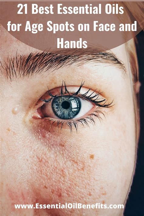 21 Best Essential Oils For Age Spots On Face And Hands Age Spots On