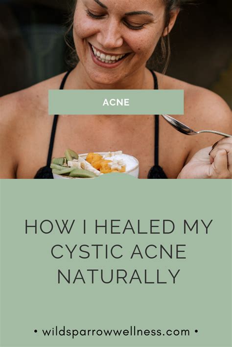 Desde Design Natural Remedies For Hormonal Cystic Acne
