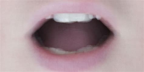 Covid Tongue May Be Another Coronavirus Symptom British Researcher