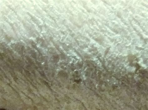 Rough Dry Patches On Skin Biofilm Skin Conditions Condition Our