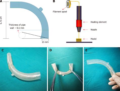 Figure 2 From Application Of A 3d Printed Fistula Stent In Plugging