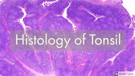 Histology Of Tonsil Youtube