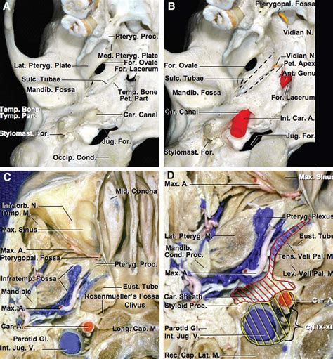 Inferior View Of The Carotid Canal And Skull Base Neuroanatomy The Neurosurgical Atlas