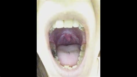 👅 What Does Your Uvula Do Say Ahhuha Up Close Mouth Back Of Throat