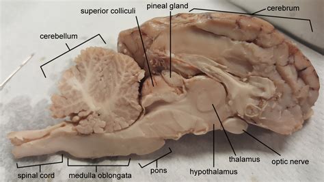 Cat Virtual Dissection (Vessels)