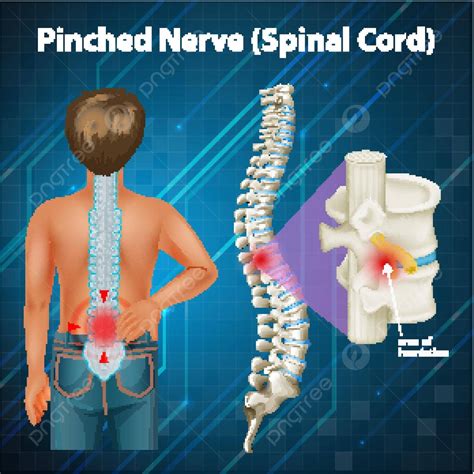 Diagram Showing Spinal Cord Design Female Anatomy Vector Design