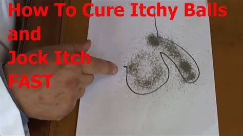 Itchy Balls Cure Watch This Otc Miracle Jock Itch Treatment Youtube