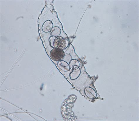 Microscopic Adventures — A Tardigrade Waterbear Hatching Tardigrades