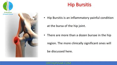 Hip Bursitis Trochanteric Bursitis OrthoFixar