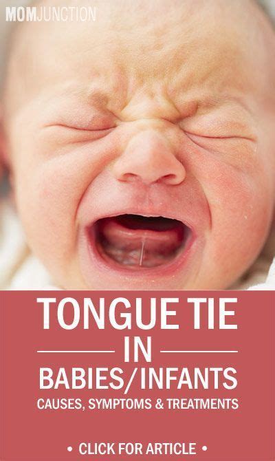 Tongue Tie In Babiesinfants Causes Symptoms And Treatments Tongue