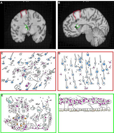 Frontiers The Neurodevelopmental Pathogenesis Of Tuberous Sclerosis