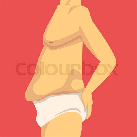 Male Torso With Sagging Fat Belly Human Body After Weight Loss Side