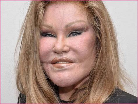 Catwoman Jocelyn Wildenstein Files For Bankruptcy Protection Plastic