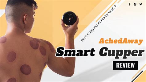 Does Cupping Actually Work Achedaway Smart Cupper Review Youtube