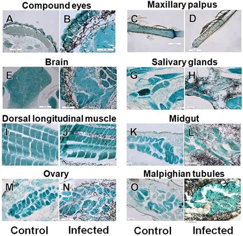 Images Showing Fungal Invasion Of Various Tissues And Organs Of