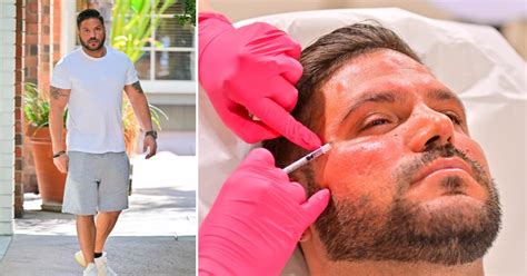 Ronnie Ortiz Magro Gets Botox Facial In L A