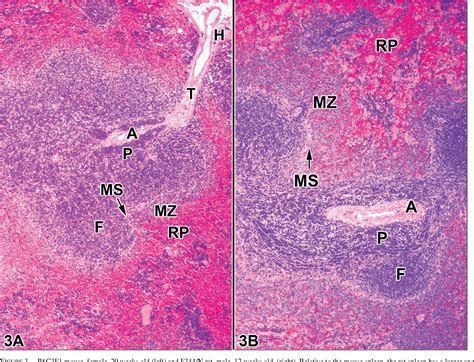 Normal Structure Function And Histology Of The Spleen Semantic Scholar