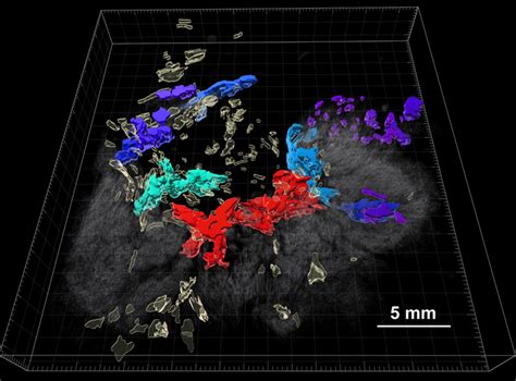 3D Reconstruction Of Colorecta IMAGE EurekAlert Science News Releases