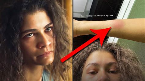 Zendaya Still Has Scars And Bruises After Filming Euphoria Season 2