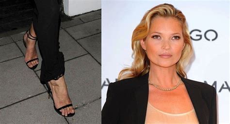 The actress with the least hot feet is claira watson parr (?). Celebrities Who Have Ugly Feet