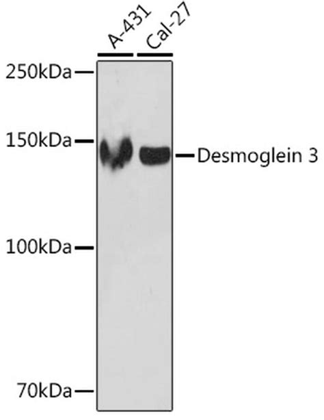 Desmoglein 3 Recombinant Monoclonal Antibody Arc1190 Ma5 35682