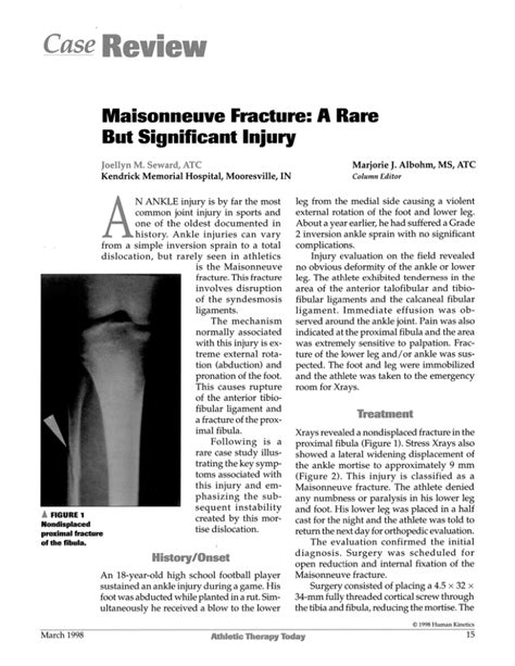 Maisonneuve Fracture A Rare But Significant Injury