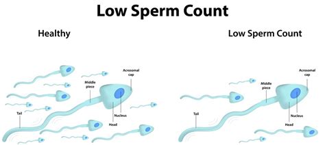Low Sperm Count Private Ivf Wandsworth Concept Fertility
