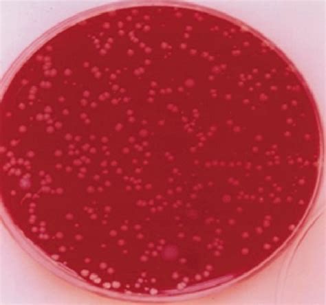Photograph Showing Bacterial Growth On A Blood Agar Plate Of A Sample