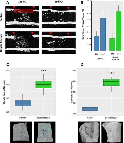 Bone Micro Ct Analysis Femora Harvested At And Weeks