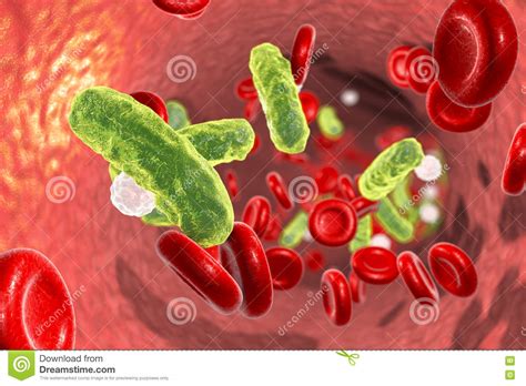 Inflammation and blood clotting during sepsis causes reduced blood flow to limbs and vital organs, and can lead to organ failure and even death. Sepsis, bacteria in blood stock illustration. Illustration of close - 81033442