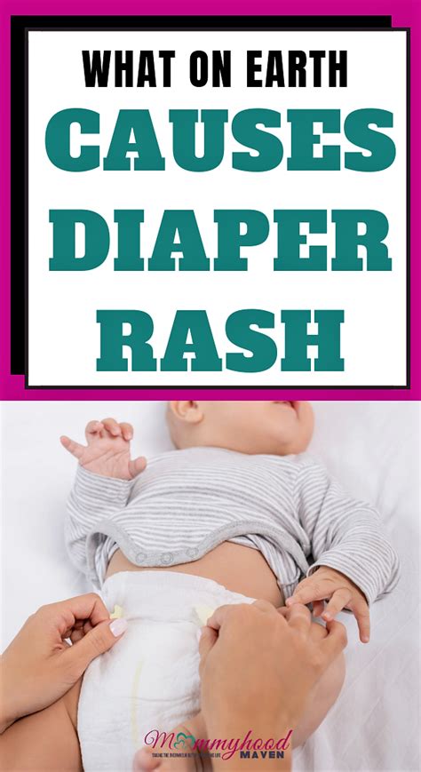 What On Earth Causes Diaper Rash Diaper Rash Baby Rash Baby Diaper Rash
