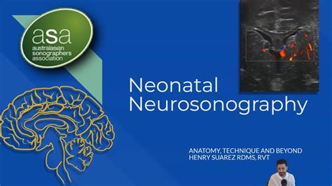 Asa 2022 Melbourne Conference Neonatal Neurosonography Youtube
