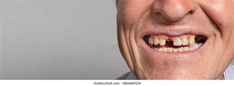 476 Toothless Old Man Images Stock Photos And Vectors Shutterstock