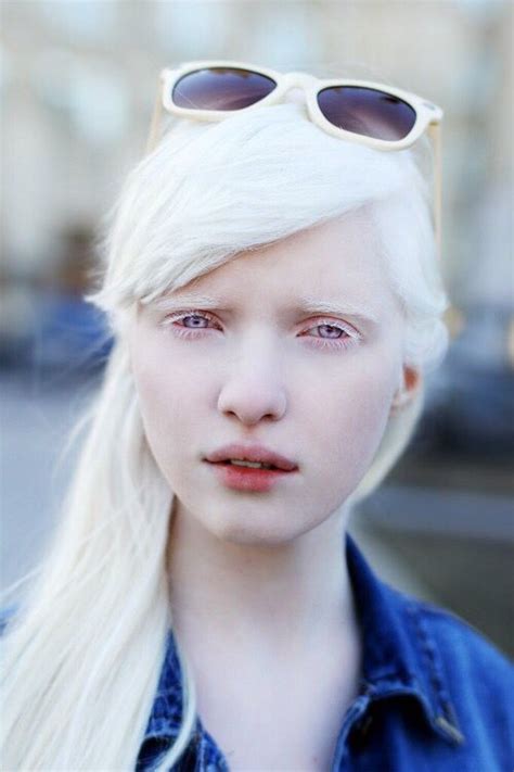 Nastya Zhidkova Albino Model With Sunglasses Albino Girl Albino Model Albino Human