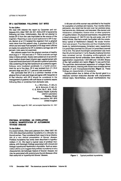 Pdf Pretibial Myxedema An Overlapping Clinical Manifestation Of