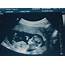 Pantel Family Blog 12 Week Ultrasound