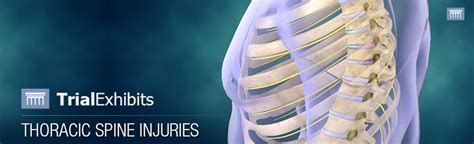 Thoracic Spine Injuries Trialexhibits Inc