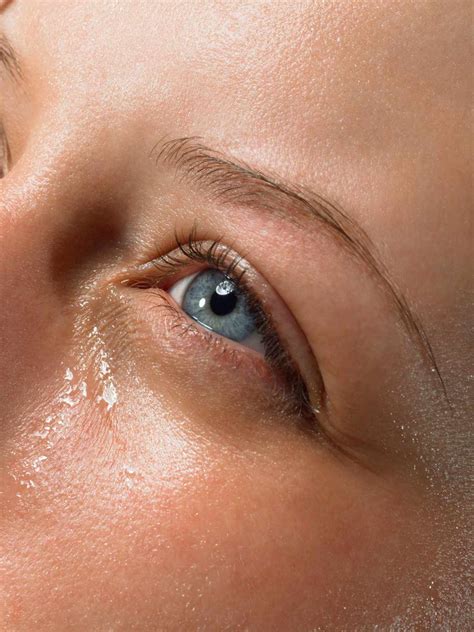 How To Stop Watery Eyes